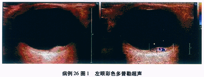 GJZC71_146_1.gif